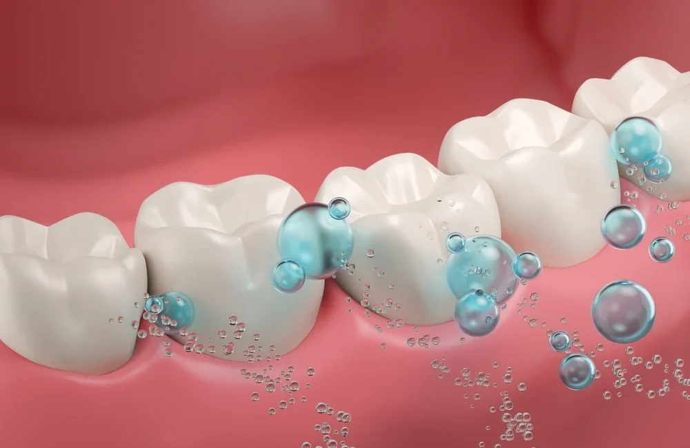 fluoryzacja dla kogo zalecenia