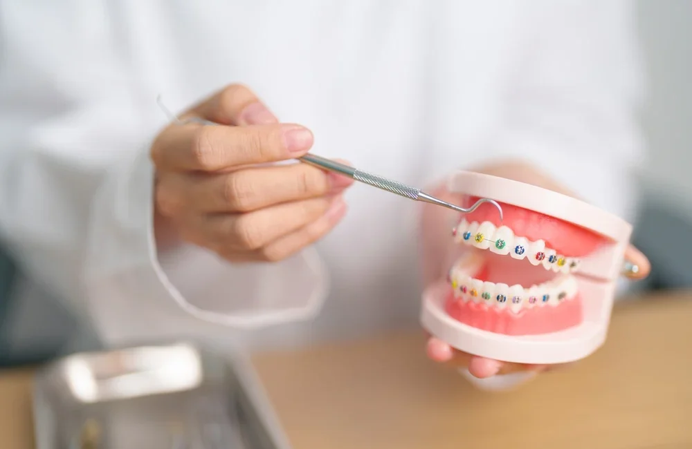 rodzaje aparatów ortodontycznych